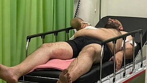 Mehmet Turan Bali'de kaldığı villada saldırıya uğradı...